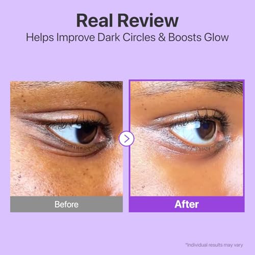 Numbuzin No.9 Nad+ Retinol Eye Cream Depuffing & Firming Eye Serum For Dark Circles Wrinkles & Fine Lines Peptides & Niacinamide For Glow & Undereye Radiance Stocking Stuffers 0.33 Fl Oz