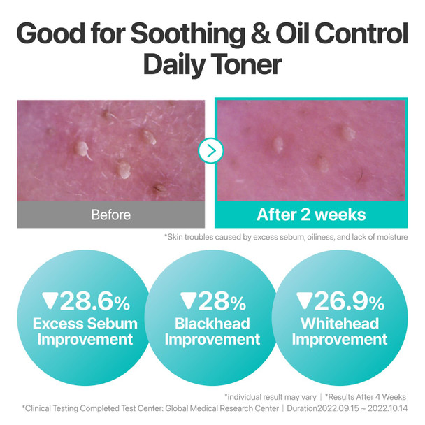 Numbuzin No.1 Toner | Pure-Full Calming Herb Toner | Breakouts Redness Excess Oil Control | Centella Asiatica Heartleaf Licorice Root | Acne-Prone Sensitive Skin | 10.14 Fl. Oz.