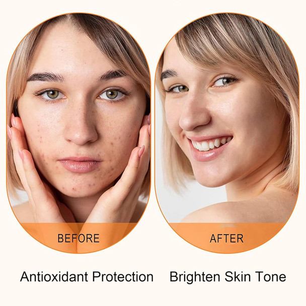 Okerker Vitamin C Serum For Face With Hyaluronic Acid 1.5Ml X 30Pcs Brightening Hydrating Facial Serum Travel Size Skincare For Glowing Skin(1.52 Fl Oz (Pack Of 1))