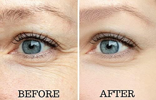 Osmotics Cosmeceuticals Osmotics Under Eye Rejuvenator Anti Aging Eye Cream For Dark Circles Eye Bags Fine Lines Puffiness. Best Anti Aging Eye Cream For Wrinkles Crows Feet And Puffy Eyes