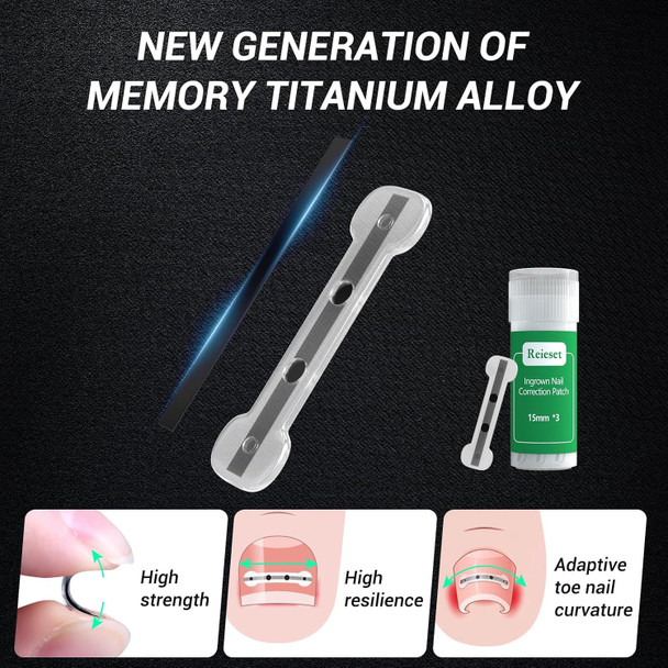 Reieset Titanium Alloy Ingrown Toenail Treatment Nail Tools And Ingrown Toenail Removal Kit Specially Designed For Curved Nail Repair And Ingrown Toenail Corrector (0.59/0.67In)