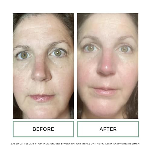 Replenix Anti-Aging Retinol + Bakuchiol Concentrated Face Serum Medical-Grade Facial Treatment For Mature Uneven Skin (1 Fl. Oz)