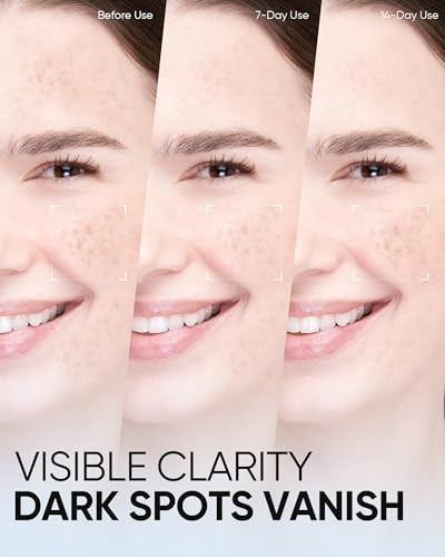 Skintific Brightening Serum Toner With 377 Pro Optical Scattering Technology Hydrating Lightens Dark Spots Evens Skin Tone Tamarind Seed Polysaccharide & Arginine For Radiant Healthy Skin