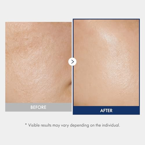 Tosowoong Ceramide Barrier Serum Hydrating Serum For Face 1250Ppm Ceramide Complex Niacinamide Collagen Panthenol Centella Glass Skin Fragrance-Free Korean Skin Care 33 Ml / 1.11 Fl. Oz.