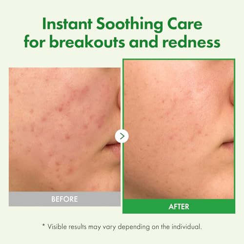 Tosowoong Madagascar Centella Cream 706580Ppm Madagascar Centella Asiatica Moisturizer Rapid Soothing Deep Hydration With Cica Complex Skin Barrier Repair Irritation Relief 50Ml / 1.69 Fl. Oz.