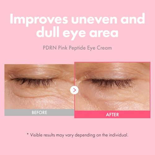 Tosowoong Pdrn Pink Peptide Eye Cream With Salmon Dna Pdrn 5000Ppm Anti Aging Formula With Caffeine & Liposome Retinol For Fine Lines Dark Circles And Wrinkles Korean Skincare 30Ml / 1.01 Fl.Oz.