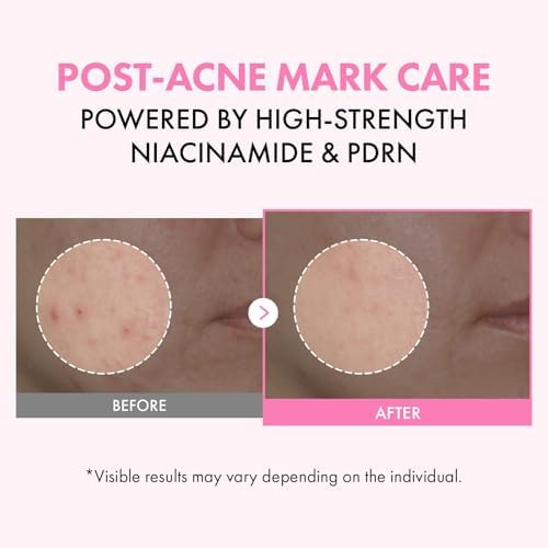 Tosowoong Pink Pdrn Niacinamide Milky Toner Niacinamide 5% Dark Spot Care Salmon Dna Pdrn Soothing 3 Ceramides & 12 Peptides Moisturizing Glass Glow Skin Korean Skincare 150Ml / 5.07 Fl. Oz.