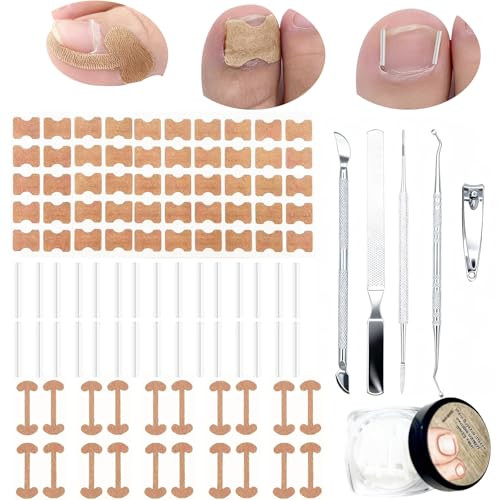 Tyalfrich Ingrown Toenail TreatmentProfessional Ingrown Toenail Removal KitHome Care Nail Clipper Set Suitable For Foot Care Repair