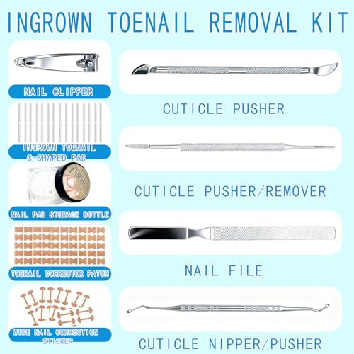 Tyalfrich Ingrown Toenail TreatmentProfessional Ingrown Toenail Removal KitHome Care Nail Clipper Set Suitable For Foot Care Repair