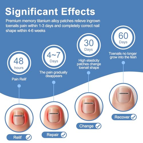 Vitasy 12Pcs Ingrown Toenail Corrector Strips For Curved Toenail Quick Relief4 Multi-Sizes Ingrown Toenail Treatment Relief Tools Kit For Home Use