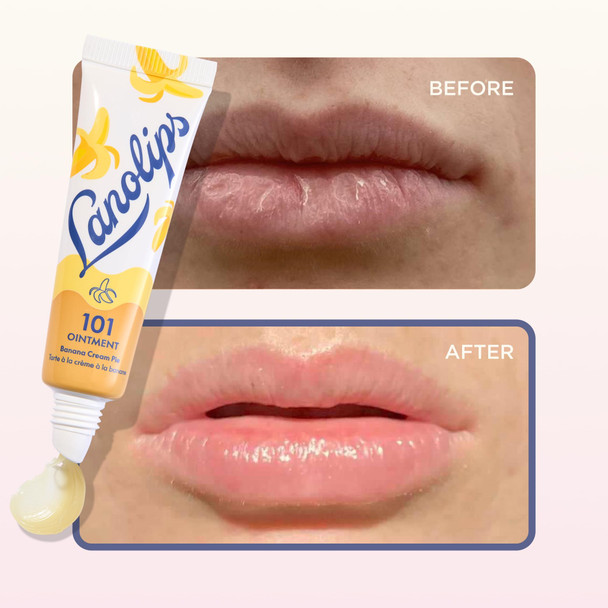 Lanolin 101 Multipurpose Ointment - Lanolin Lip Balm & Healing Ointment for Skin Barrier Repair - Moisturizer for Dry Lips  Cuticles & Elbows - No Petroleum Formula - Banana Cream Pie (0.35 oz)