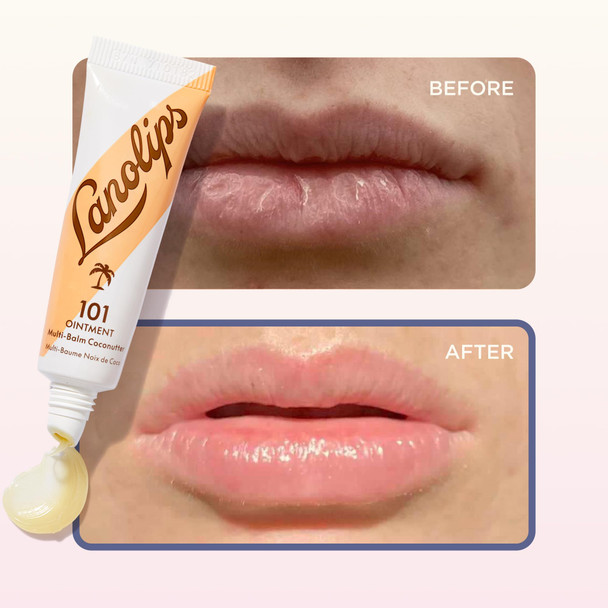 Lanolin 101 Multipurpose Ointment - Lanolin Lip Balm & Healing Ointment for Skin Barrier Repair - Moisturizer for Dry Lips  Cuticles & Elbows - No Petroleum Formula - Coconutter (0.35 oz)