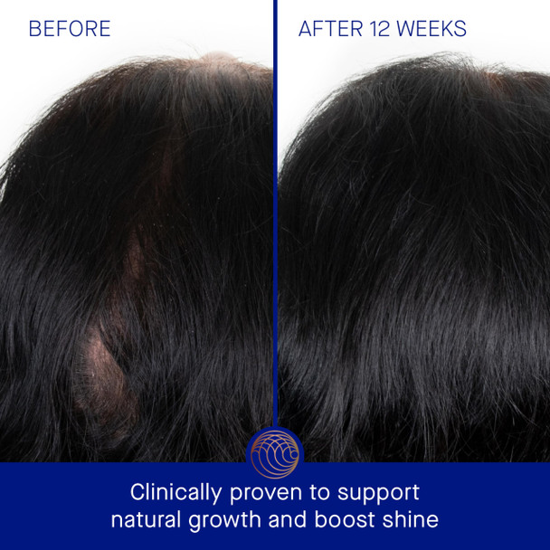 Augustinus Bader Women'S The Scalp Treatment