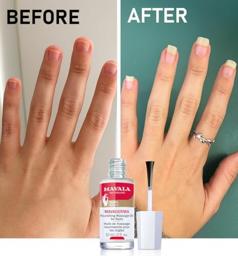 Mavala Mavaderma Nourishing Massage Oil For Nails Nail Care Nail Hardener Cuticle Oil Nail Growth Moisturizing & Healing Treatment For Cracked Nails & Rigid Cuticles (0.3 Ounce)