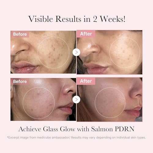 Medicube Salmon Dna Pdrn Trial Kit | Glow Mini Skincare Set With Toner Serum & Sheet Mask For Hydrating Firming Moisturizing | & Travel Essentials For Women & Girls | Korean Skincare