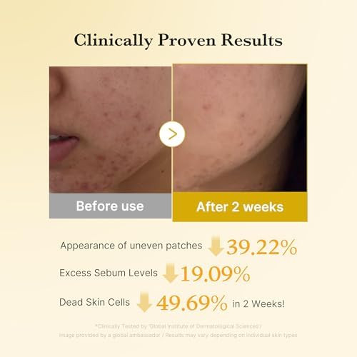 Medicube Kojic Acid Renew & Smooth Duo For Troubled Skin: Kojic Acid Turmeric Clarifying Toner Pad And Kojic Acid Turmeric Clarifying & Balancing Capsule Serum