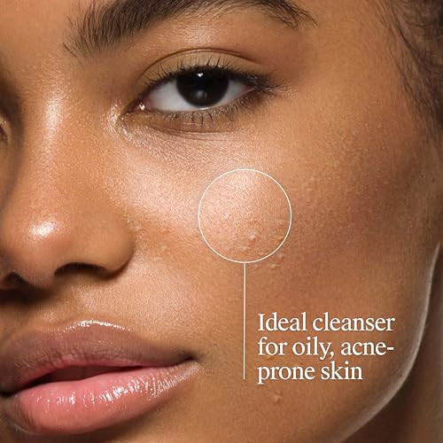 Neutrogena Oil-Free Acne Face Wash - Facial Cleanser With Salicylic Acid Daily Cleanser For Oily & Acne-Prone Skin Clears & Helps Prevent Breakouts Clear Formula 9.1 Fl. Oz. Bottle