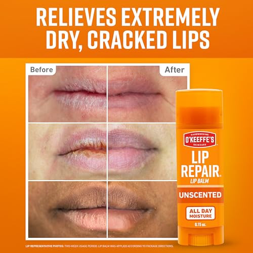 O'Keeffe'S Lip Repair Unscented Lip Balm For Dry Cracked Lips - Stick (3 Pack) - Moisturizer For Very Dry Lips