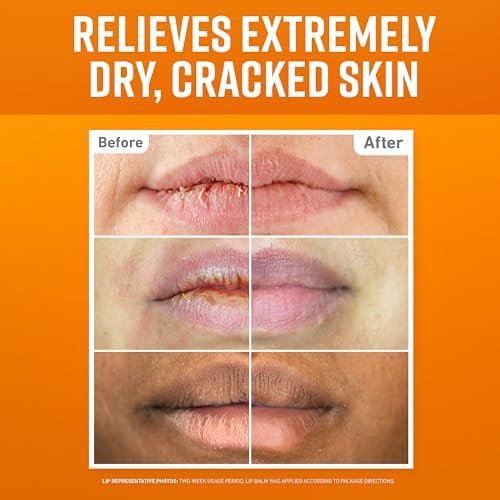 O'Keeffe'S Lip Repair Lip Balm Set For Dry Cracked Lips - Stick (Pack Of 3: 1 Cooling + 1 Unscented + 1 Spf) - Moisturizer For For Extremely Cracked Dry Lips