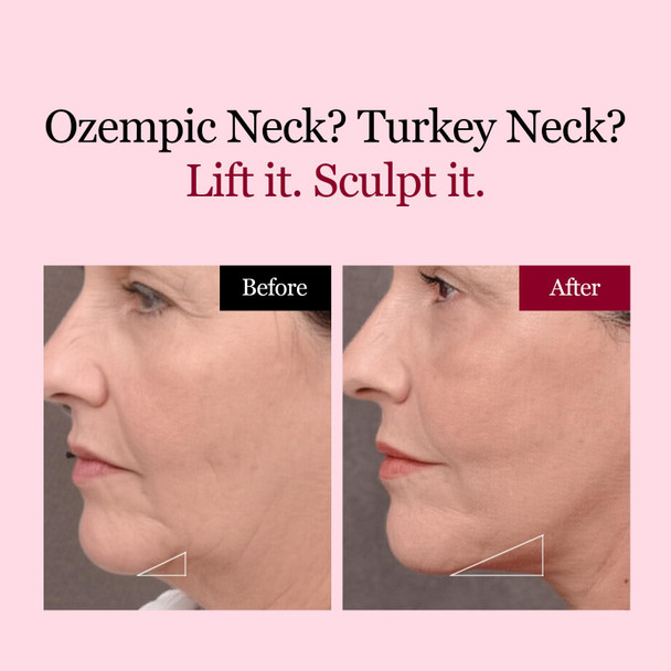 Round Lab Camellia Deep Collagen V Lifting Gel Mask 1Ea | Double-Chin Turkey Neck Instant Face Lifting Mask Cooling And Depuffing Face Toning Belt Firming Sagging Skin Korean Skin Care 10G/0.35Oz