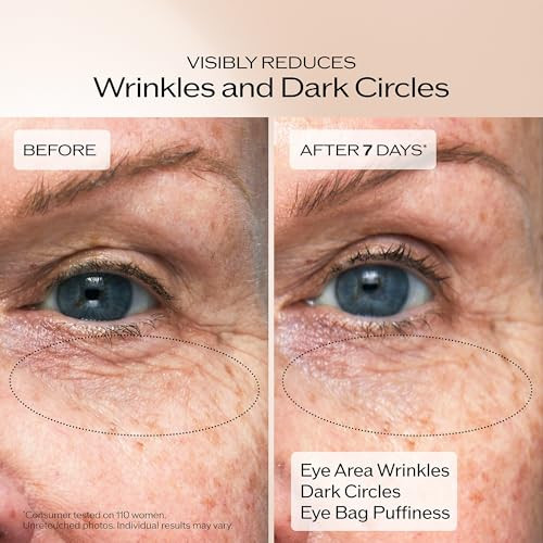 Shiseido Benefiance Wrinkle Smoothing Eye Cream - 15 Ml - Visibly Improves Five Types Of Eye Wrinkles Dark Circles & Puffiness - 48-Hr Hydration - All Skin Types - Non-Comedogenic