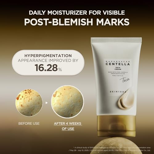 Skin1004 Madagascar Centella Teca Cream Korean Centella Face Moisturizer For Blemish-Prone Skin With Teca & Pdrn Cica Cream For Oil & Ph Balance With Vitamin E Korean Skin Care 2.53 Fl.Oz / 75Ml