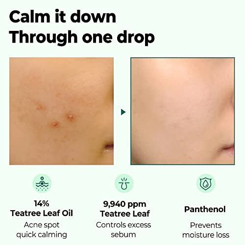 Some By Mi 30 Days Miracle Tea Tree Clear Spot Oil / 0.33Oz 10Ml / Made From Tea Tree Leaf Water For Sensitive Skin/Moisturizing Rapid Trouble And Sebum Control/Facial Skin Care