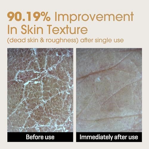 Some By Mi Galactomyces Glutathione Glow Milky Toner - 6.76Oz 200Ml - Hydrating Korean Milky And Rice Toner With Glutathione & Vitamin C For Smooth Radiant Skin - Korean Skin Care