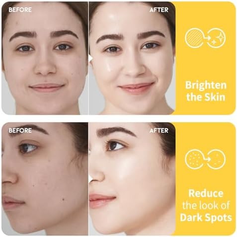 Ootd Vitamin C Toner For Face Formula With Niacinamide Heartleaf And Squalane 8.45 Fi Oz
