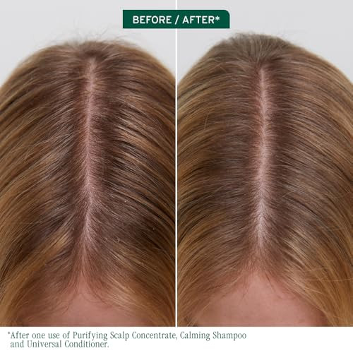 Biolage Scalp Sync Purifying Concentrate - Exfoliating & Clarifying Dry Scalp Treatment Refreshing & Reinvigorating Fermented Tea Blend & Glycolic Acid