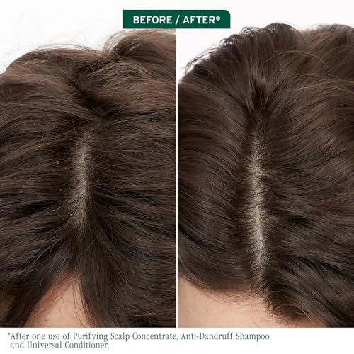 Biolage Scalp Sync Purifying Concentrate - Exfoliating & Clarifying Dry Scalp Treatment Refreshing & Reinvigorating Fermented Tea Blend & Glycolic Acid