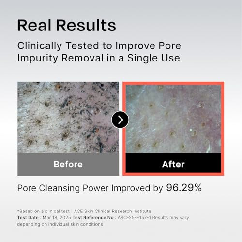 Celladix 131 Pore Care Bha Gel Cleanser Gentle Daily Face Wash For Oily Sensitive & Acne-Prone Skin Pore Minimizer With 10% 4Ha Complex Hydrating Deep Cleanse Korean Skincare 6.76 Fl Oz