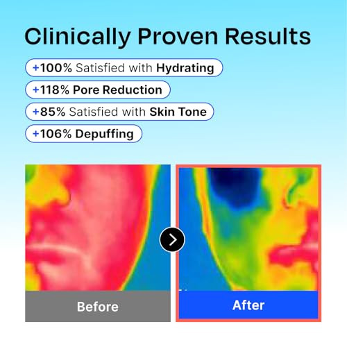 Celladix Hyaluronic Frozen Sherbet Mask 95% Pure Hyaluronic Acid With Niacinamide & Aha Instant Cooling For Morning Depuff Hydration Lifting & Pore Refining Korean Skincare 9 Pods 4.22 Fl Oz