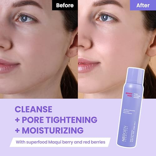 Dermalogy By Neogenlab Berrypore Pore Cleansing Mousse Deep Pore Cleanser With Aha/Bha Removes Excess Oil & Impurities K-Beauty Face Wash 5.07 Fl Oz (150 Ml)