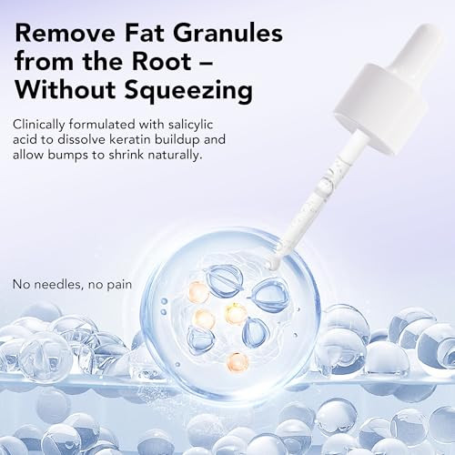 Dermfree Milia Remover 30 Ml Milia Remover Treatment Milia Spot Treatment With Salicylic Acid Milia Acne Serum Clearing Skin Essence