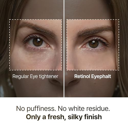 Dr.Melaxin Retinol Eyebag Cream For Puffiness Dark Circles & Fine Lines Wrinkle Egf Anti-Aging Under Eye Moisturizer With Niacinamide&Ceramide Makeup Friendly Korean Skin Care
