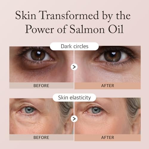 Eyenlip Salmon Peptide Eye Cream 1.18 Fl Oz - Daily Lightweight Cream With Niacinamide And Nutrition-Rich Complex For A Refreshed Under-Eye Look Korean Skincare Routine