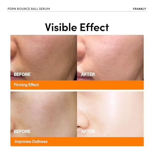 Frankly Korean Glow Serum Duo Skincare Gifts For Women Glass Skin Radiance & Elasticity Set Peptide Pore Minimizer + Pdrn Salmon Dna Serum Vegan Collagen Non-Sticky 2X1.01 Fl.Oz