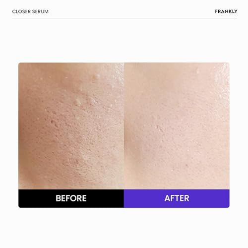 Frankly Dark Spot Wrinkle & Pore Care Set Niacinamide Serum + Retinol Night Cream + Peptide Pore Serum Complete Korean Routine Skincare Gifts For Women
