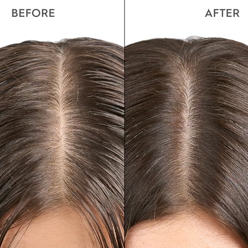 Kerasilk Exfoliating Scalp & Hair Treatment For Deep Cleansing & Oil Regulation Color-Safe 200Ml