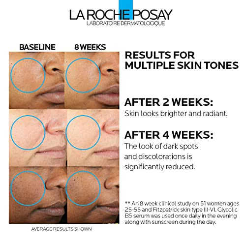 La Roche-Posay Glycolic Acid Serum With Tranexamic Acid Kojic Acid And Vitamin B5 Reduces Dark Spots And Discoloration Skin Tone Corrector To Brighten And Even Skin Tone