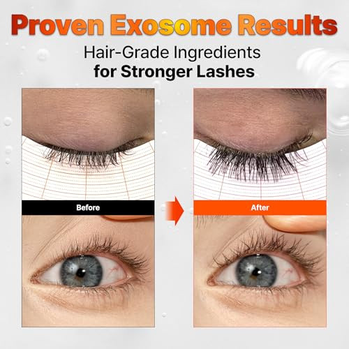 Lilyeve Growturn Eyelash Growth Serum Korean Lash Enhancing Serum For Longer Natural Lashes 2-In-1 Dual Lash Serum For Day & Night Care Prostaglandin With Biotin & Exosome 0.27 Fl. Oz