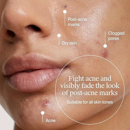 Neutrogena Evenly Clear Acne Gel Moisturizer With Salicylic Acid & N-Acetyl Glucosamine Lightweight Non-Greasy Face Moisturizer Helps Treat Breakouts & Visibly Fade The Look Of Post-Acne 1.7 Fl. Oz