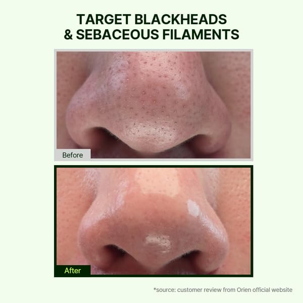 Orien Mugwort Zero Film Cleansing Oil 6.76 Fl.Oz. 200Ml Daily Makeup Blackhead Removal No Pore Clogging Korean Skincare Double Cleansing