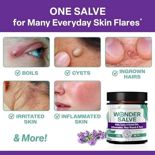 Owell Naturals Wonder Salve Drawing Salve Maximum Strength For Irritated & Flare-Prone Skin Hs Hemorrhoids Boils Cyst Ingrown Hair Bumps Anti-Chafing With Natural Propolis And Egg Yolk Extract 2 Oz