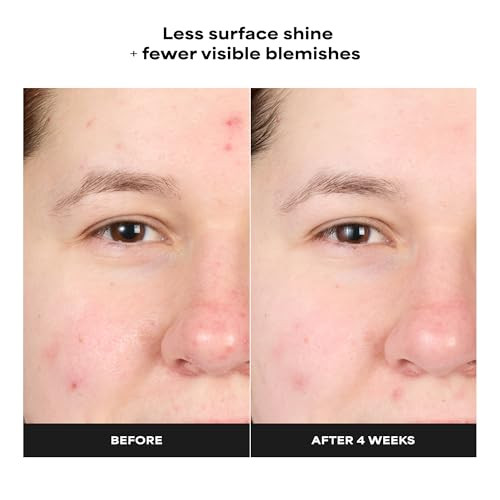 Paula's Choice Skin Perfecting 4% Bha Advanced Exfoliating Serum Toner Facial Smoother With Salicylic Acid & Antioxidants Anti-Aging Serum For Skin Texture Clogged & Enlarged Pores Fragrance-