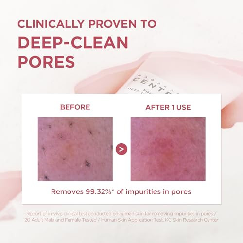 Skin1004 Poremizing Deep Cleansing Foam 4.23 Fl.Oz 125Ml Makeup Remover Korean Face Cleanser With Himalayan Pink Salt & Madagascar Centella Asiatica For Facial Pore Cleansing Korean Skin Care