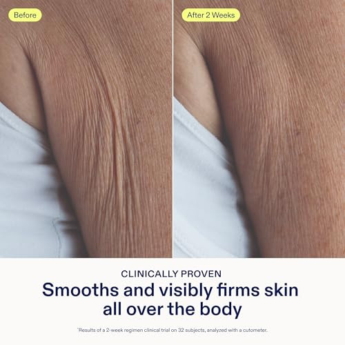 Skinfix Glycolic Renewing Scrub - 8 Oz - Dual-Action Exfoliating Body Treatment With Lactic Acid - Smooths Rough Patches Removes Flakes & Improves Skin Texture - Vegan Cruelty