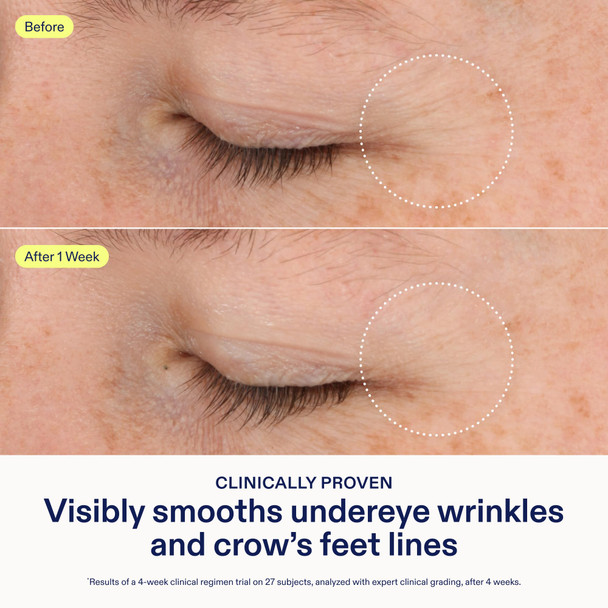 Skinfix Triple Lipid-Boost 360 Eye - 0.5 Fl Oz - Visibly Smooths Undereye Wrinkles & Crow S Feet Lines With Hyaluronic Acid - Non-Comedogenic - Vegan Cruelty - Founded In Canada