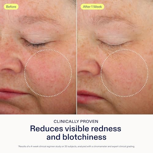 Skinfix Antioxidant Tetrapeptide Soothing Treatment - 1.7 Oz - Overnight Face Mask - Visibly Calms Redness & Hydrates Skin - Non-Comedogenic - Vegan Cruelty